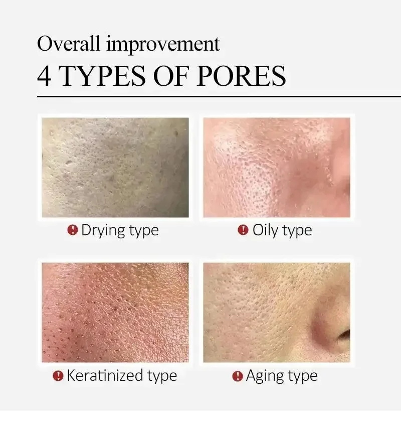 Centella Asiatica Shrink Pores - Luxury Skincare Korea 评论和价格